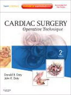 Cardiac Surgery: Operative Technique