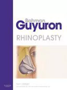 Rhinoplasty Guyuron