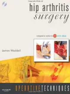 Operative Techniques:Hip Arthritis Surgery
