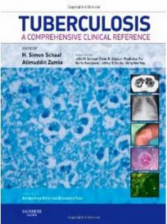 Tuberculosis: A Comprehensive Clinical Reference