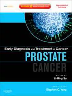 Early Diagnosis And Treatment Of Cancer Series: Prostate Cancer