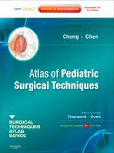 Atlas Of Pediatric Surgical Techniques