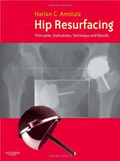 Hip Resurfacing: Principles, Indications, Technique and Results