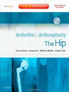 Arthritis And Arthroplasty: The Hip
