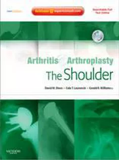 Arthritis And Arthroplasty: The Shoulder