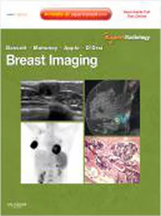 Expert Radiology Series: Breast Imaging