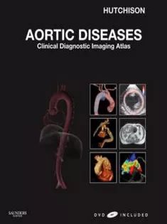 Aortic Diseases,Clinical Diagnostic Imaging Atlas