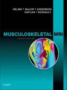 Musculoskeketal MRI