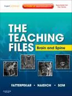 The Teaching Files: Brain and Spine Imaging