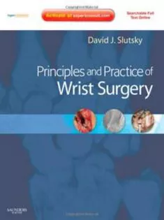 Principles and Practice of Wrist Surgery