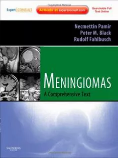 Meningiomas