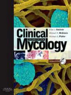 Clinical Mycology