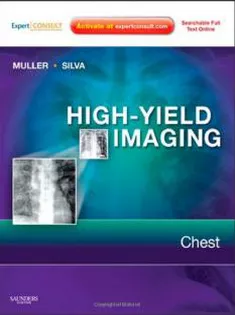 High-Yield Imaging: Chest