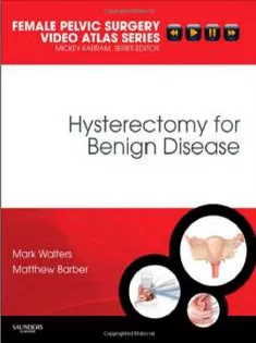 Female Pelvic Surgery Pelvic Surgery Hysterectomy for Benign Disease