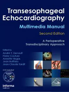 Transesophageal Echocardiography Multimedia Manual