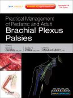 Practical Management of Pediatric and Adult Brachial