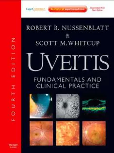Uveitis, Fundamentals & Clinical Practice