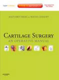 Cartilage Surgery