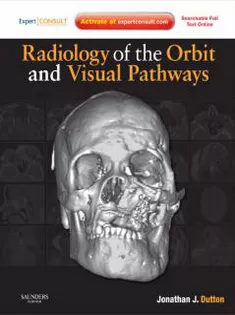 Radiology Of The Orbit And Visual Pathways