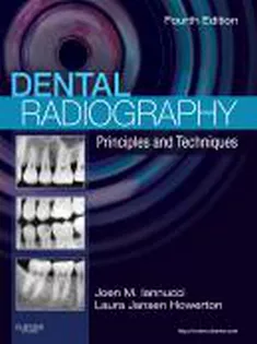 Dental Radiography: Principles and Techniques1
