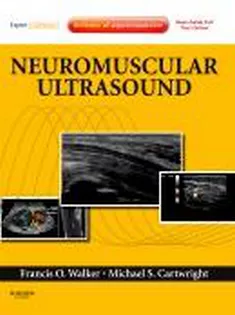 Neuromuscular Ultrasound