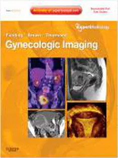 Expert Radiology Series: Gynecologic Imaging