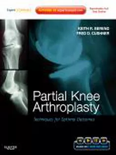 9781437717563 Partial Knee Arthroplasty: Techniques for Optimal Outcomes