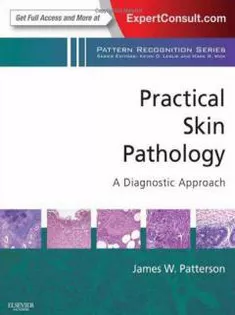 Practical Skin Pathology: A Diagnostic Approach