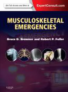 9781437722291 Musculoskeletal Emergencies