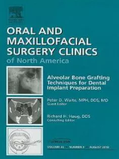 Alveolar Bone Grafting Techniques for Dental Implant Preparation, An Issue of Oral and Maxillofacial Surgery Clinics