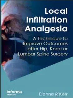 Local Infiltration Analgesia: A Technique To Improve Outcomes After Hip, Knee Or Lumbar Spine Surgery