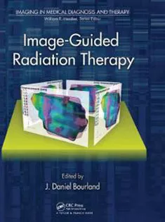 Image-Guided Radiation Therapy