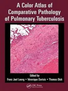 A Color Atlas of Comparative Pathology of Pulmonary Tuberculosis