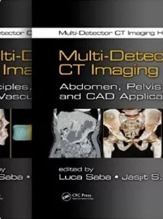 Multi-Detector CT Imaging Handbook, Two Volume Set