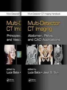 Multi-Detector CT Imaging Handbook
