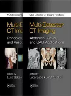 Multi-Detector CT Imaging Handbook