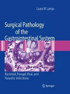 Surgical Pathology of the Gastrointestinal System: Bacterial, Fungal, Viral, and Parasitic Infections