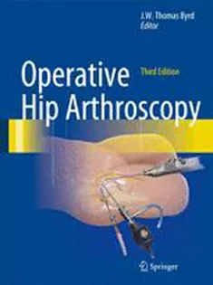 9781441979247 Operative Hip Arthroscopy