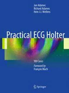 9781441999542 Practical ECG Holter :100 Cases
