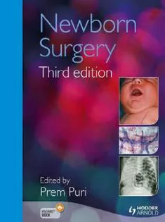 Newborn Surgery
