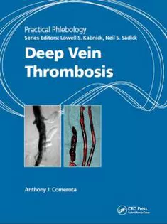 Practical Phlebology Deep Vein Thrombosis