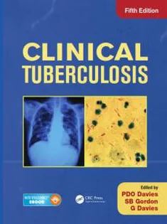 Clinical Tuberculosis1