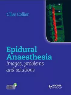 Epidural Anaesthesia: Images, Problems and Solutions