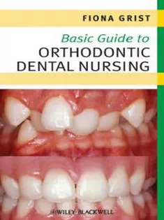 Basic Guide to Orthodontic Dental Nursing