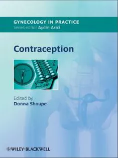 Gynecology in Practice : Contraception