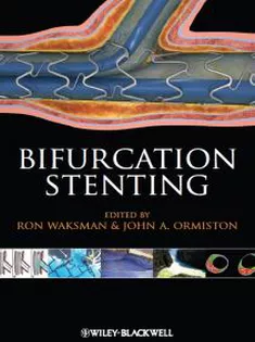 Bifurcation Stenting