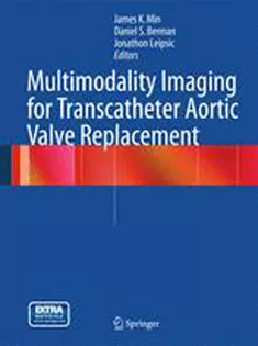 9781447127970 Multimodality Imaging for Transcatheter Aortic Valve Replacement