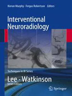 9781447145813 Interventional Neuroradiology-Techniques in Interventional Radiology