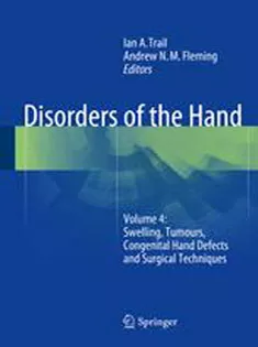 9781447165620 Disorders of the Hand: Volume 4: Swelling, Tumours, Congenital Hand Defects and Surgical Techniques