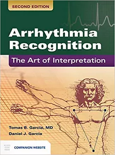 Arrhythmia Recognition: The Art of Interpretation